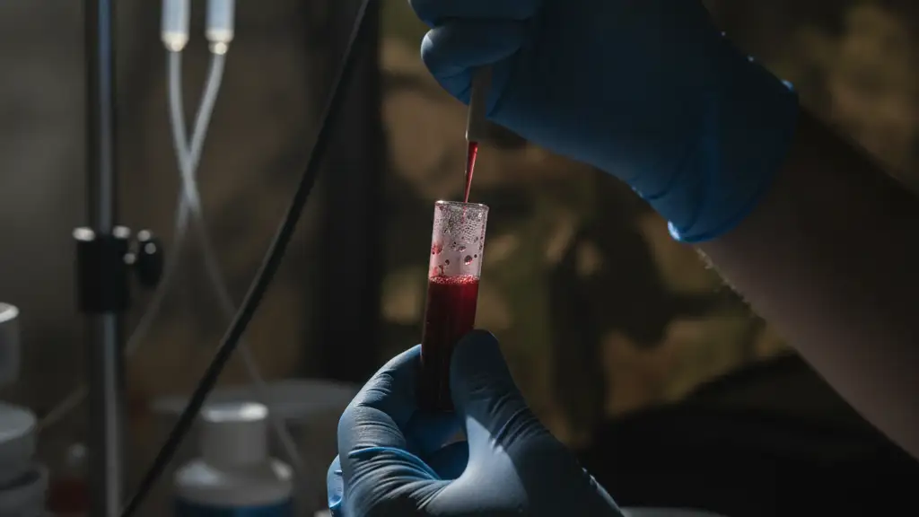 Gloved hands holding a blood sample vial in a medical setting.